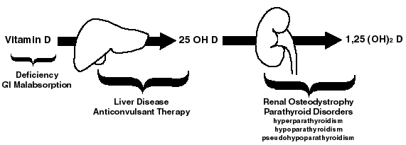 Osteomalacia Diagram 3