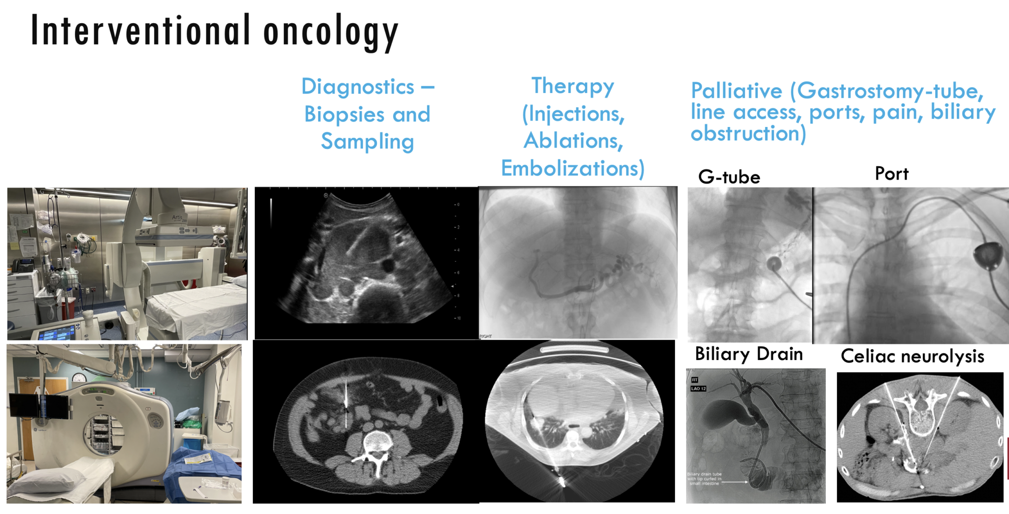 Image collage displaying various Interventional Oncology instruments and fluoroscopy scans of patients