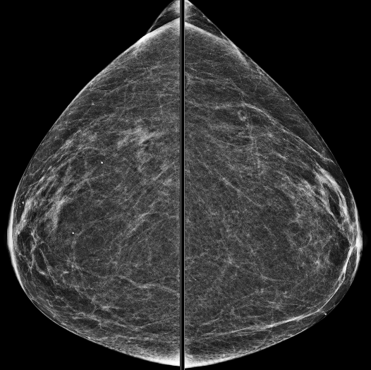 Case 2 | UW Radiology