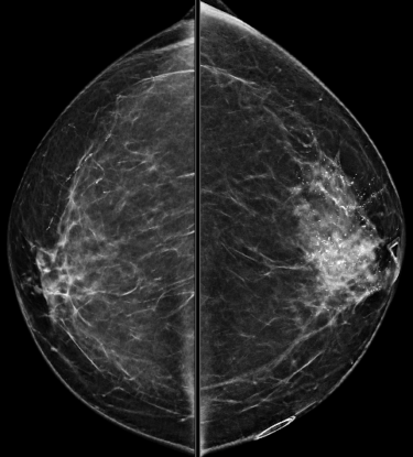 Case 3 | UW Radiology