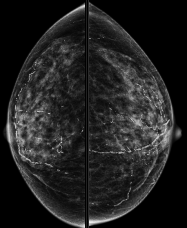 Case 4 | UW Radiology