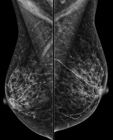 Case 4 | UW Radiology