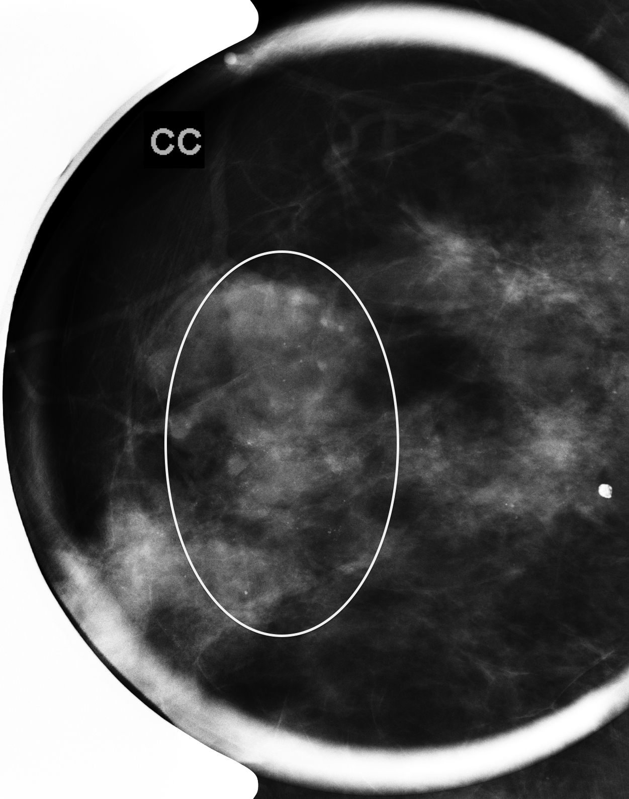 Case 16 | UW Radiology