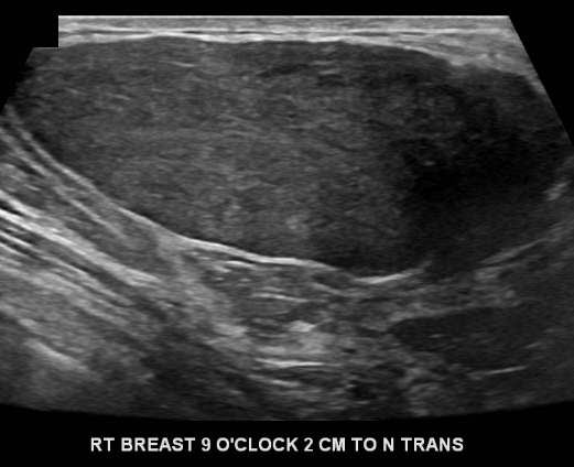 Case 17 | UW Radiology