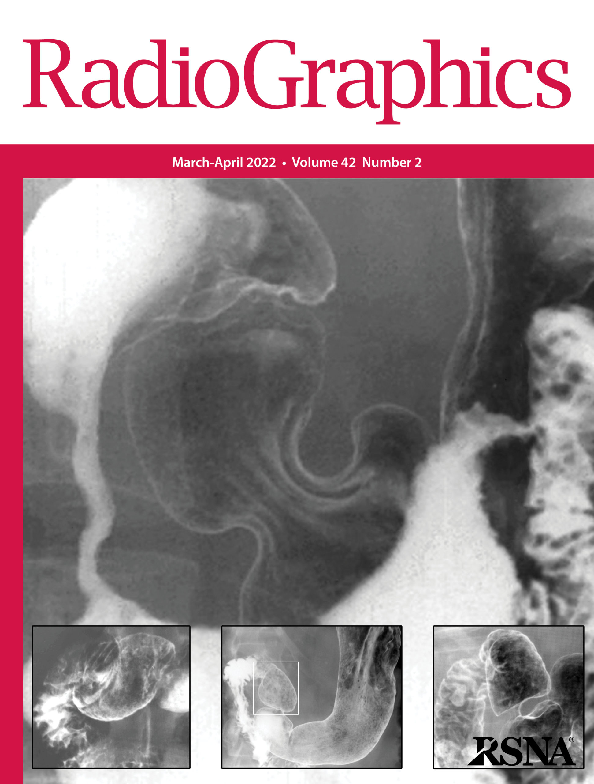 The March cover of the journal RadioGraphics features images from an article written by UW Radiology faculty and trainees. 