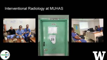 A slide that reads: Interventional Radiology at MUHAS. Pictured are doctors sharing coffee, a restroom door, and doctors viewing a slide show.