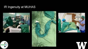 A slide that reads: IR ingenuity at MUHAS. Three photos depict doctors working in a hospital, medical equipment resting on a table, and medical staff performing a procedure.