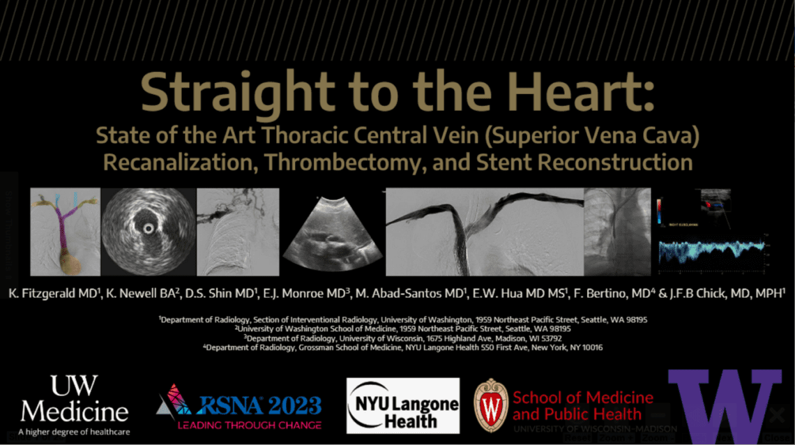 A graphic with radiographic images. The text reads: Straight to the Heart: State of the Art Thoracic Central Vein (Superior Vena Cava) Recanalization, Thrombectomy, and Stent Reconstruction along with author names and several logos.