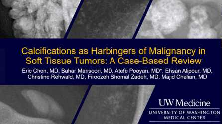 “Calcifications as Harbingers of Malignancy in Soft Tissue Tumors: A Case-Based Review” by Atefe Pooyan, MD, MPH, and other authors