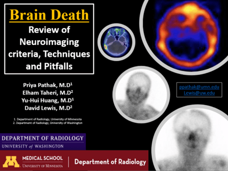 "Brain Death: Review of Neuroimaging Criteria, Techniques and Pitfalls," by Priya Omprakash Pathak, MBBS, MD